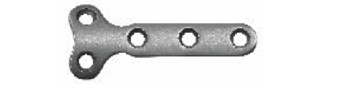 T-подібна пластина для фаланги пальця UMP